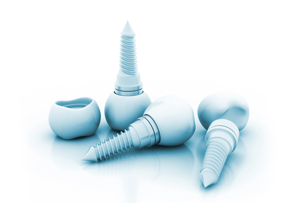 Common Signs Of Gum Disease Around Dental Implants
